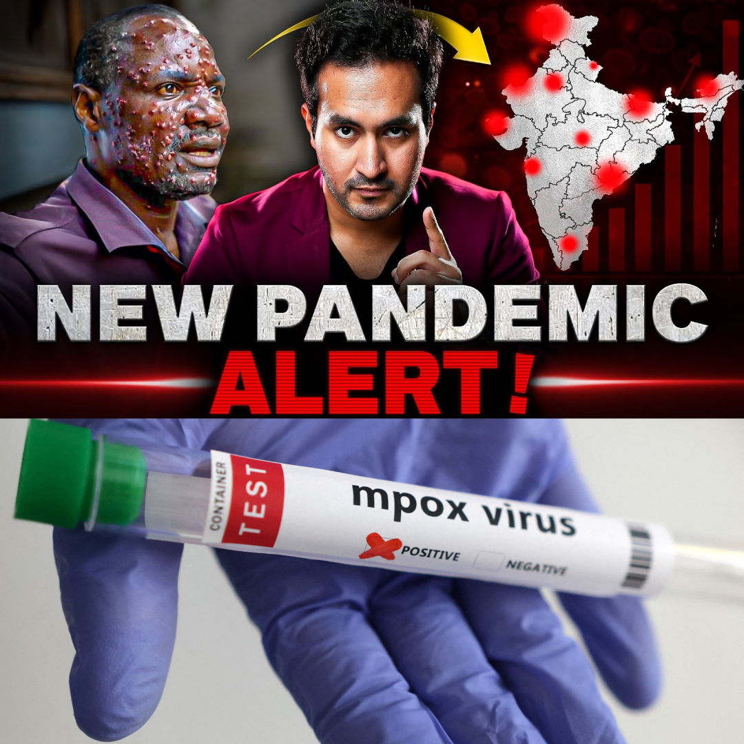 ALERT! New PANDEMIC is Spreading Across The World MPOX Virus